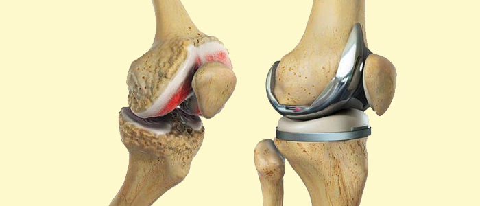 Orthopaedic Surgery