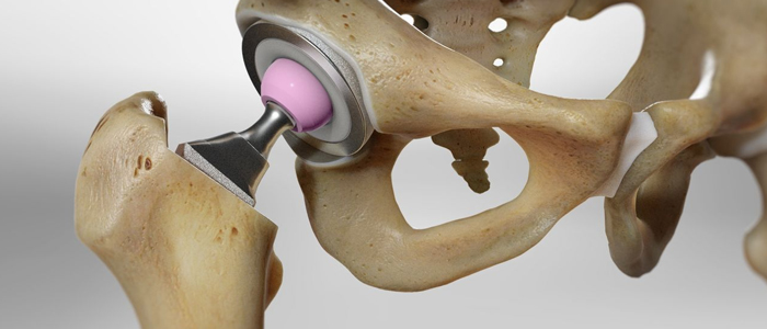 Orthopaedic Surgery