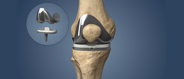 Orthopaedic Surgery