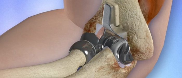 Orthopaedic Surgery